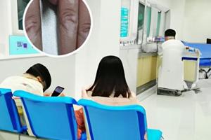 他卡西醇软膏用大半年无明显效果