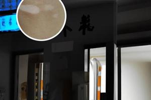 他克莫司服用时间规定