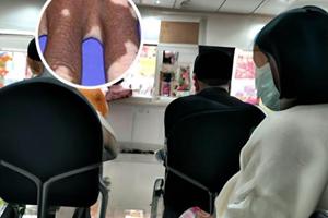 丙酸倍他米松膏