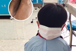 马来酸阿法替尼片说明书