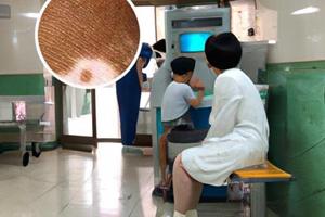 草本乳膏治癣吗
