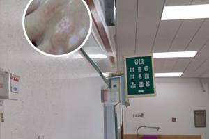 用了他克莫司软膏白斑变大了正常吗