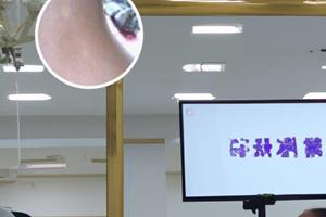 苏孜阿甫片的使用量