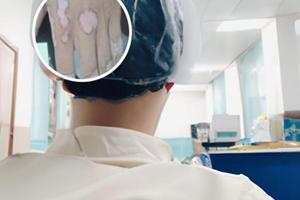 白灵片治疗白斑多久见效