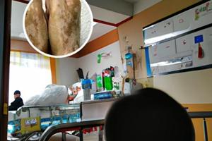 40mg甲强龙等于多少泼尼松