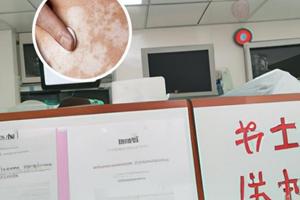 苯海拉明能长期吃吗